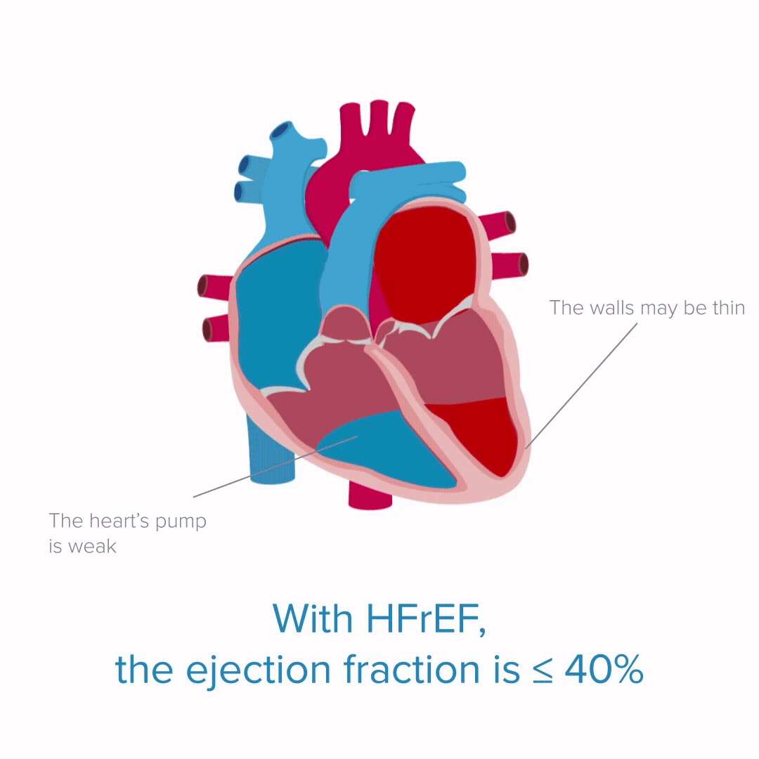 A diagram of a heart

Description automatically generated